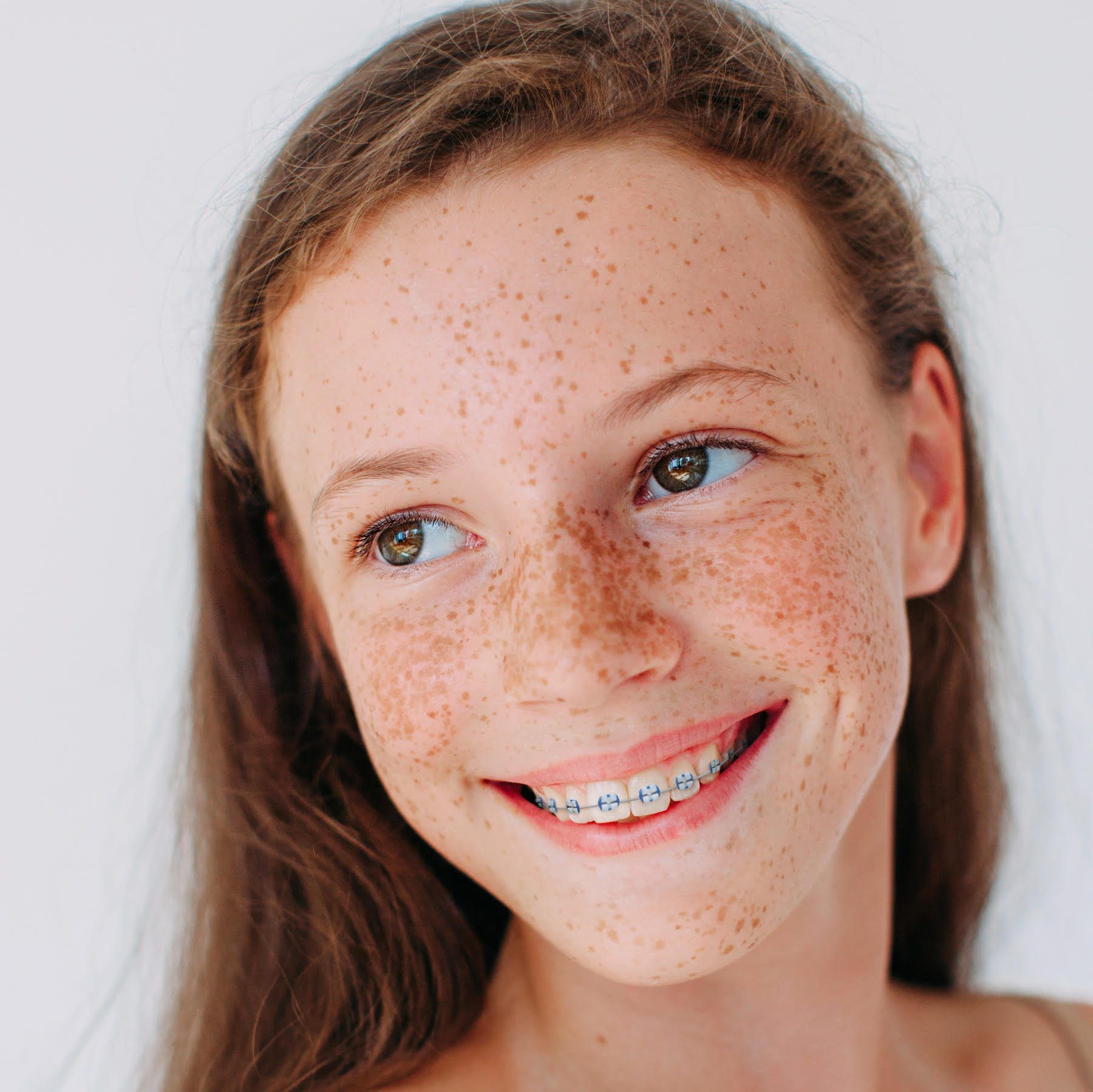 Braces in Glen Cove